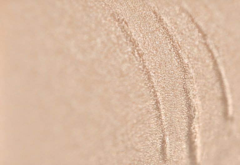 Scar tissue and pain The Physio Company